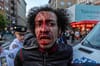 The bloody face of someone arrested at a vigil for Jordan Neely on May 8, 2023.